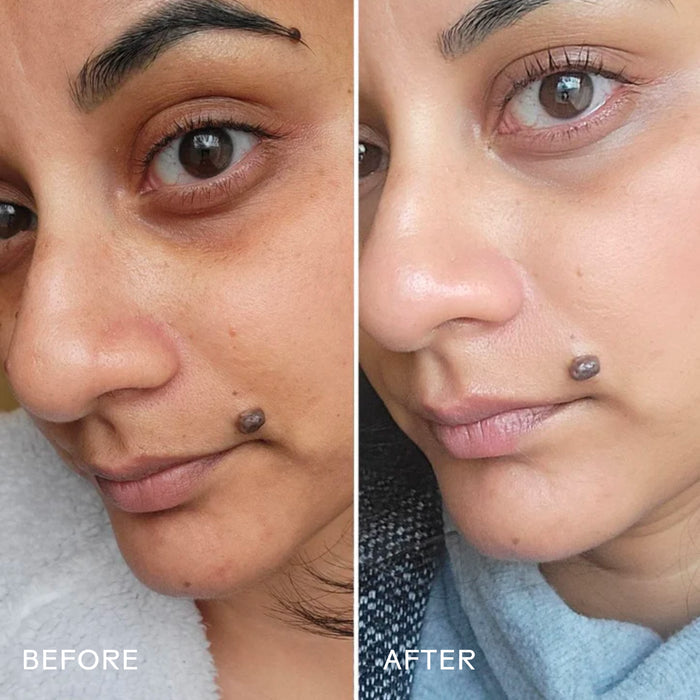 Side-by-side close-ups of a woman’s face before and after using Three Ships Brighter Days Red Algae + Avocado Biodegradable Eye Mask show smoother skin and less noticeable under-eye circles.